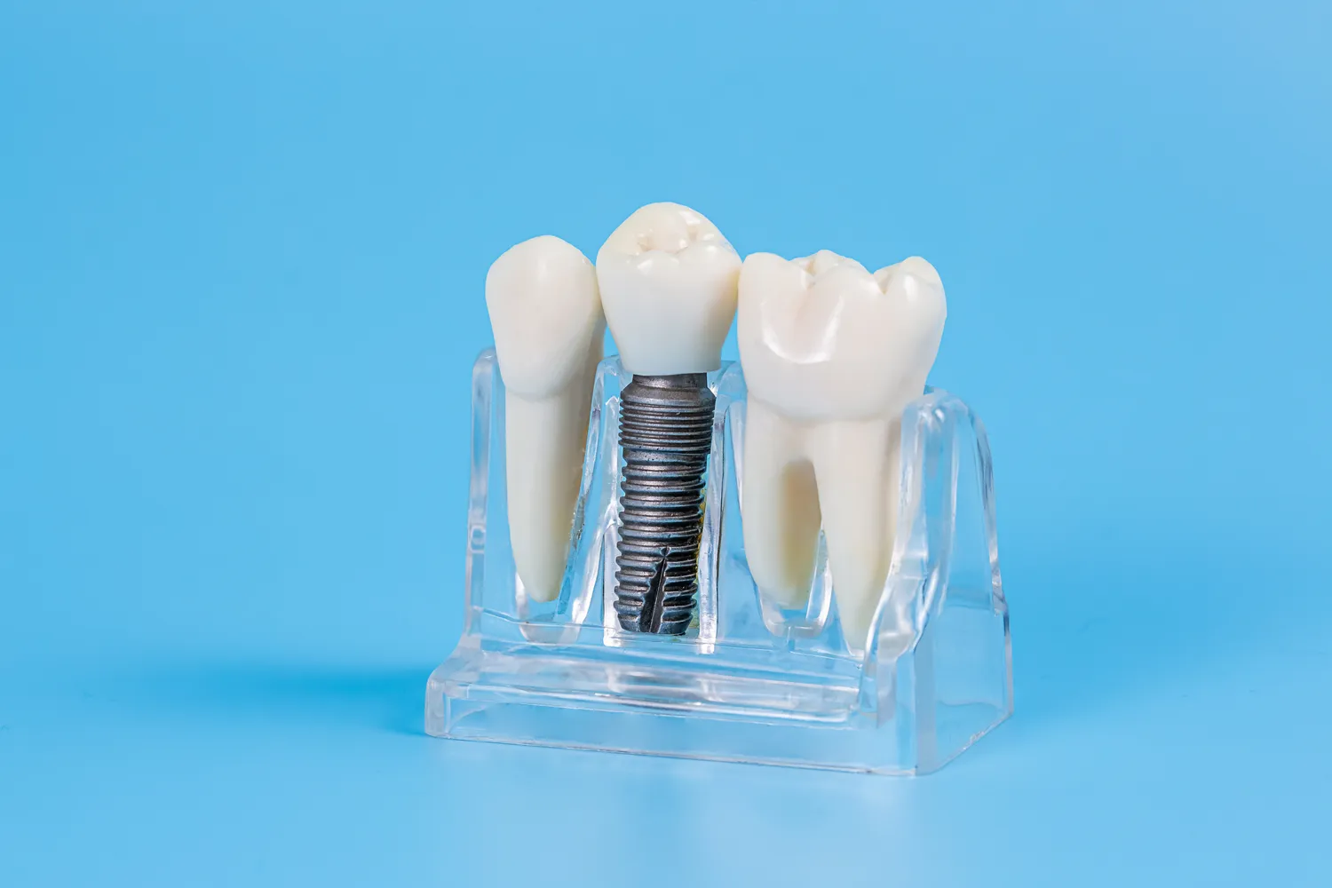 Najlepszy dentysta Szczecin